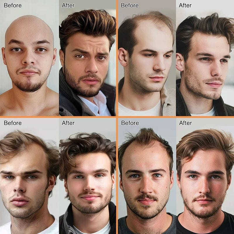 EMEDA French full lace remy hair piece men's toupee hair replacement system for men prosthetic stock