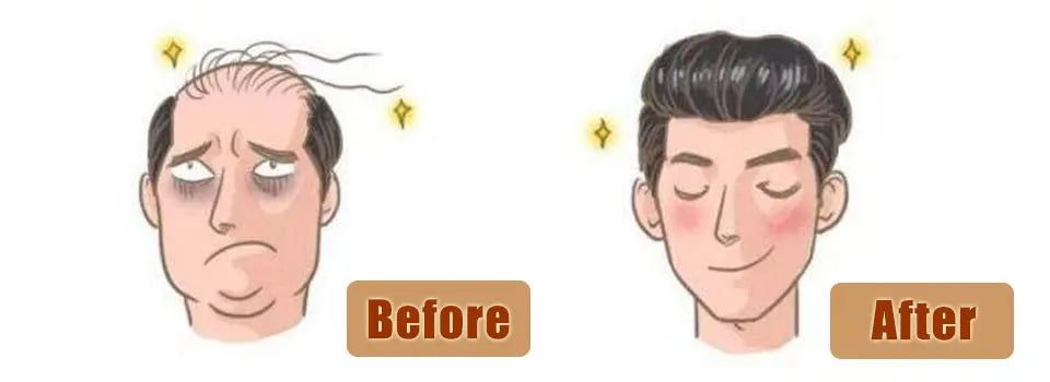Natural Hairline Human Hair Toupee Hair System for Men