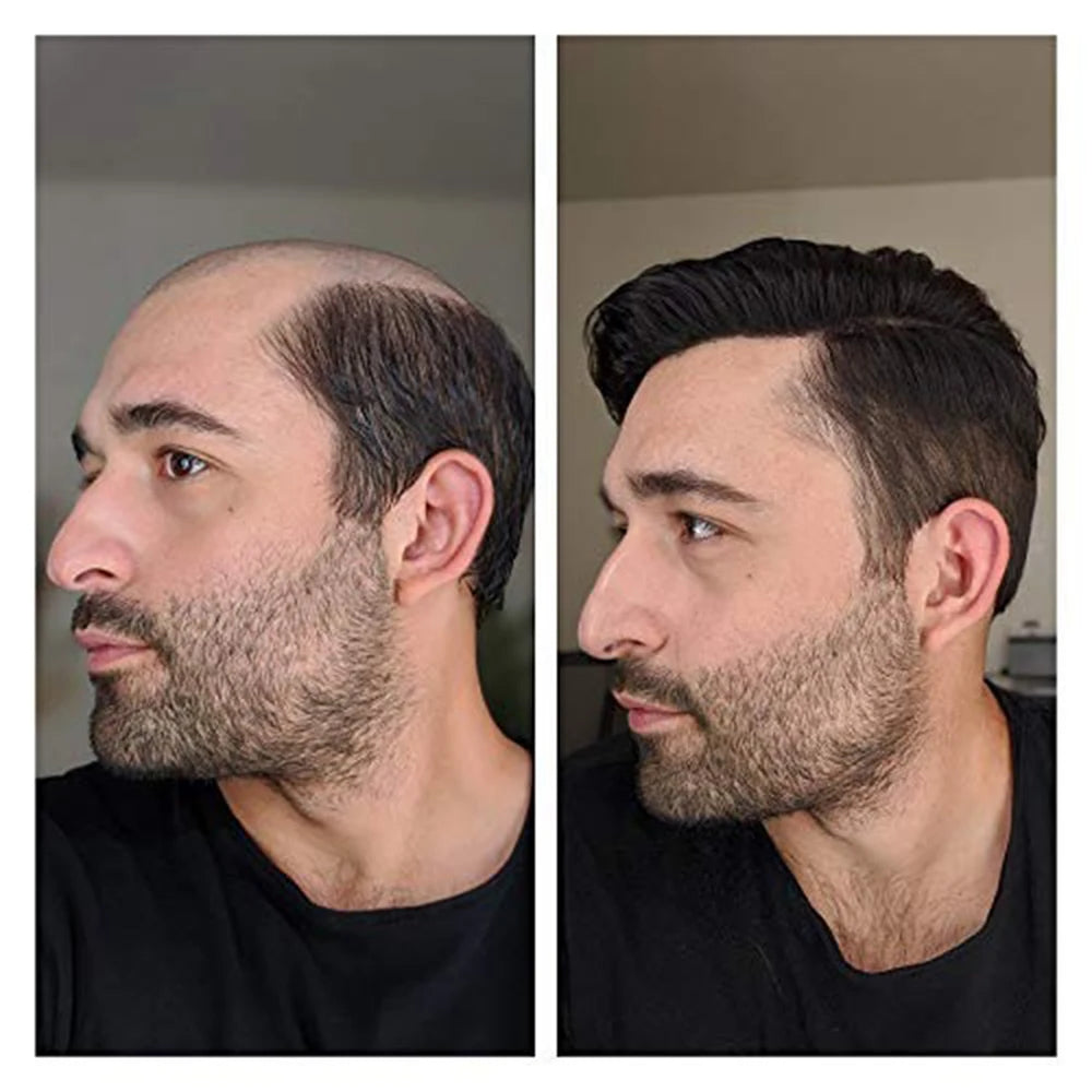 Natural Gray Human Hair Toupee With Realistic Hairline for Men