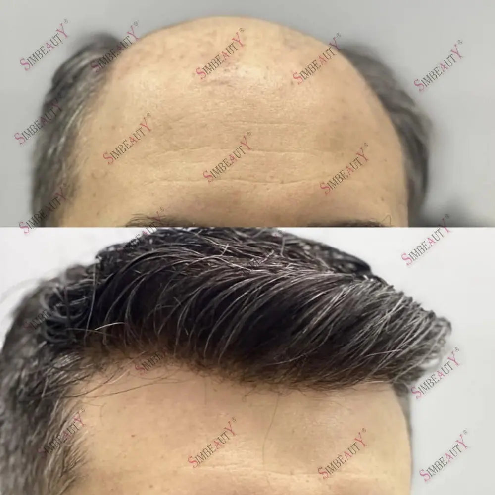 Natural Hairline Human Hair Skin Base Toupee for Women