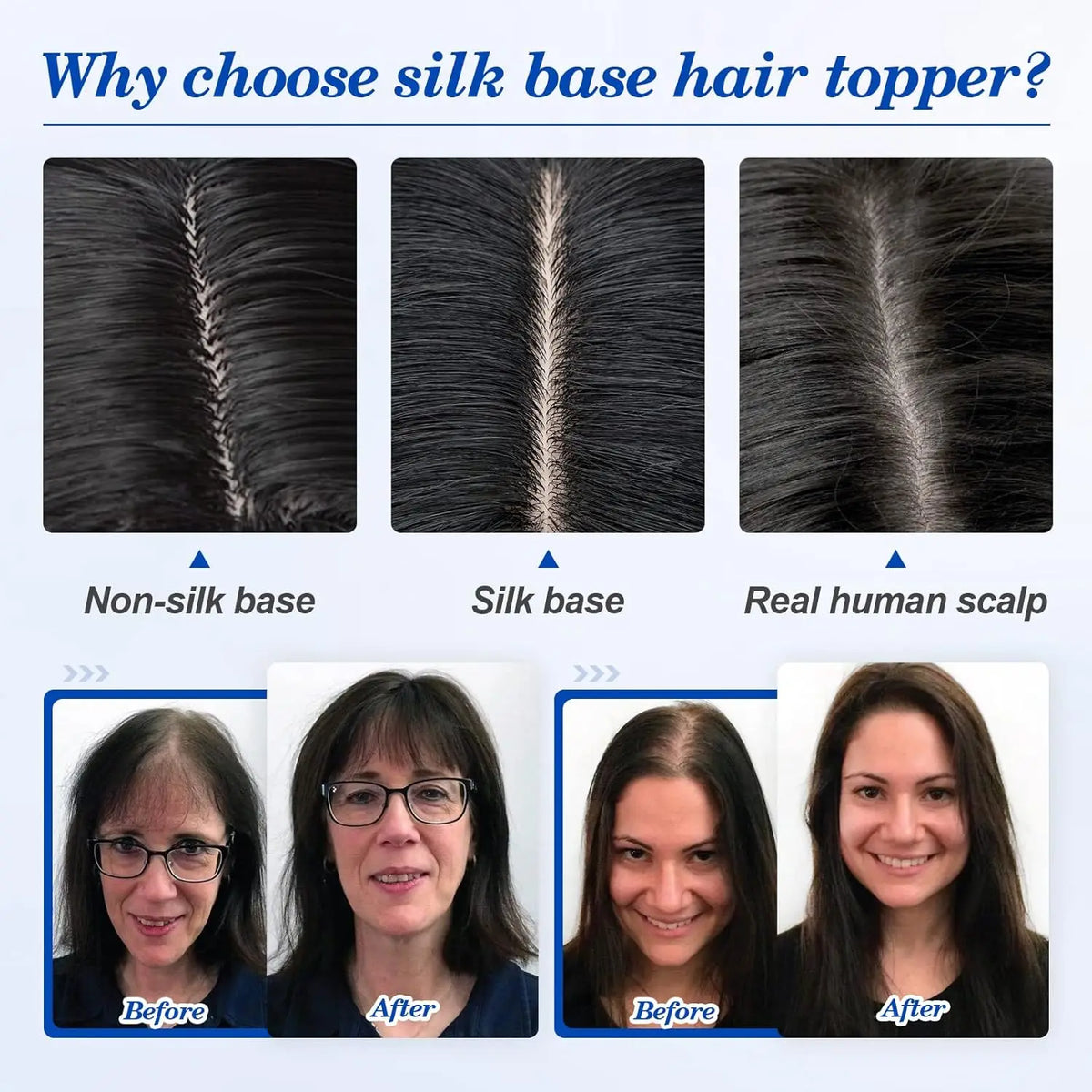 Natural Straight Silk Base Human Hair Topper for Women