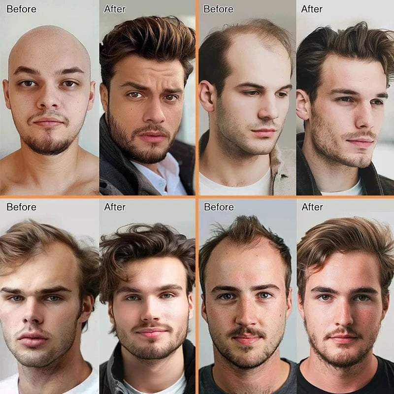 EMEDA cheaper korea toupee for men curly hair replacement system toupees stock